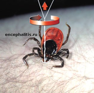 http://encephalitis.ru/uploads/posts/1176107755_tick_off2.jpg